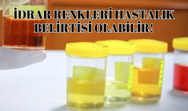 İdrar renklerinin anlamı nedir? İdrar da nelere dikkat edilmeli?